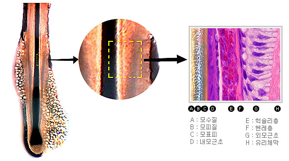 모발전문자료 - 모근